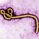 A colorized transmission electron micrograph of an Ebola virus virion
Centers for Disease Control and Prevention via Getty Images